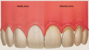 Soft-Tissue-Management